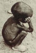 hungrychild2
